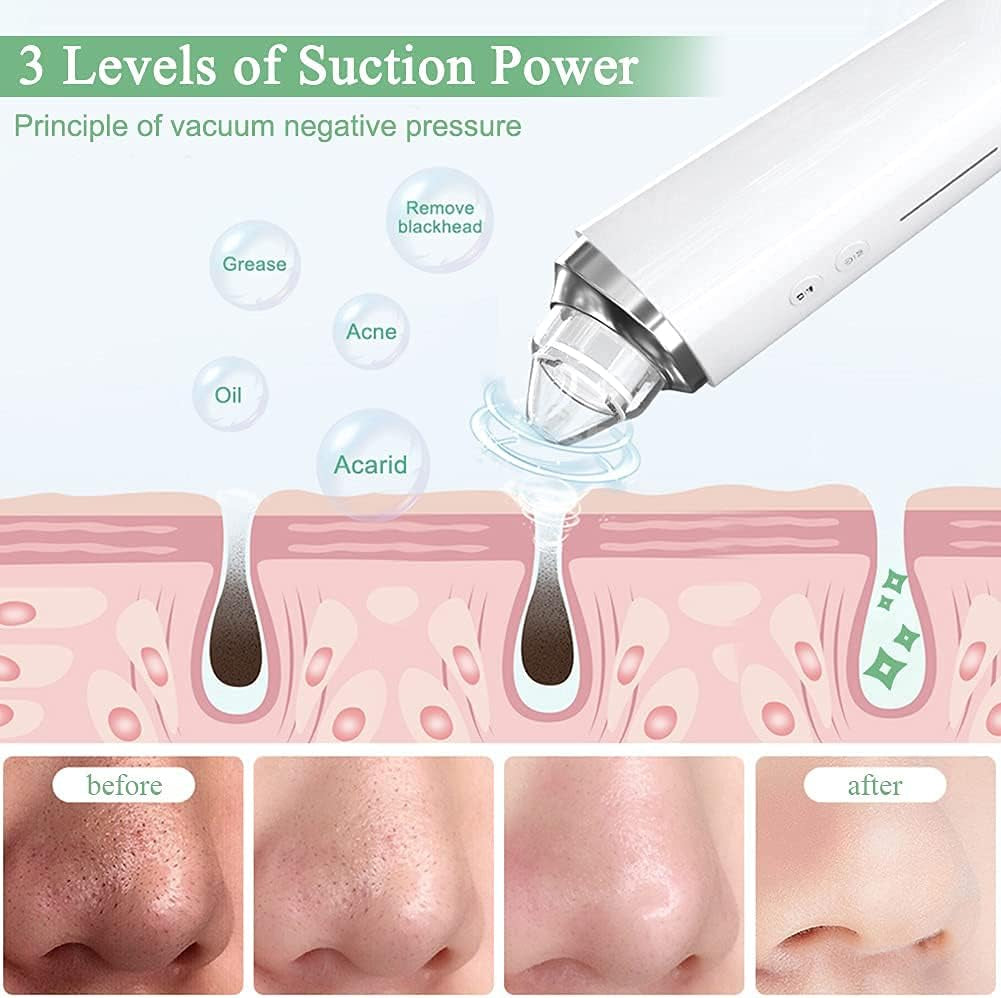 Blackhead Remover Pore Vacuum, 【[FDA Certification] 】 Wifi Visible Facial Pore Cleanser with HD Camera Pimple Acne Comedone Extractor Kit with 6 Suction Heads Electric Blackhead Suction Tool